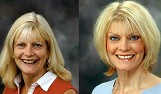 Drs. Kenneth Robin Rawlinson, LLC | Veneers, Dental Fillings and Extractions