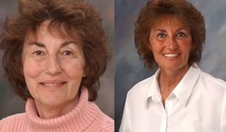 Drs. Kenneth Robin Rawlinson, LLC | Extractions, Oral Exams and Dentures