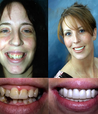 Drs. Kenneth Robin Rawlinson, LLC | Teeth Whitening, Preventative Program and Veneers