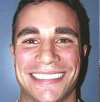 Drs. Kenneth Robin Rawlinson, LLC | Root Canals, Oral Exams and Extractions