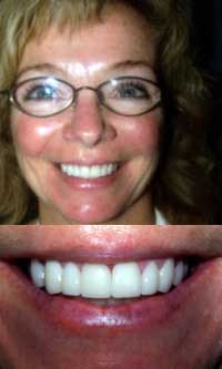 Drs. Kenneth Robin Rawlinson, LLC | Extractions, Periodontal Treatment and Invisalign reg