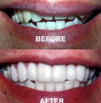 Drs. Kenneth Robin Rawlinson, LLC | Root Canals, Sleep Apnea and Preventative Program