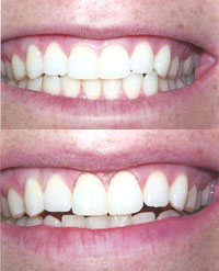 Drs. Kenneth Robin Rawlinson, LLC | Crowns, Dental Fillings and Periodontal Treatment